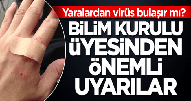 Yaralardan koronavirüs bulaşır mı? Bilim Kurulu üyesi cevapladı