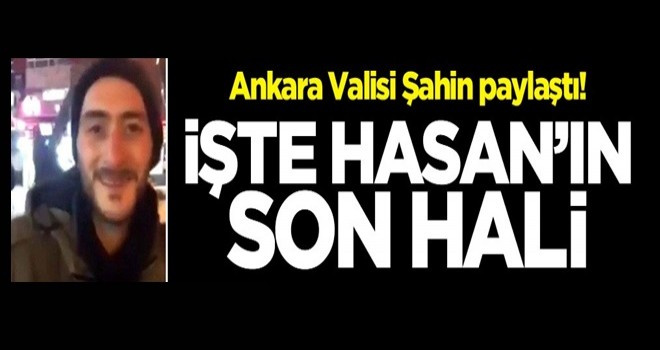 Ankara Valisi Vasip Şahin, Hasan M.'nin son halini paylaştı