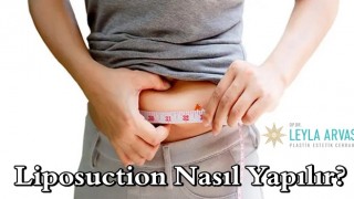 Gerçek güzellik potansiyelinize Liposuction sayesinde ulaşın!