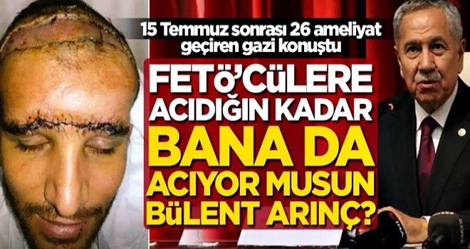 15 Temmuz sonrası 26 ameliyat geçiren gazi konuştu: FETÖ’cülere acıdığın kadar bana da acıyor musun Bülent Arınç?