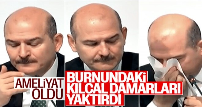 Süleyman Soylu'nun burnundaki kılcal damarları yakıldı