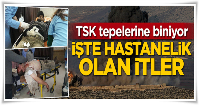 TSK tepelerine biniyor! İşte hastanelik olan itler