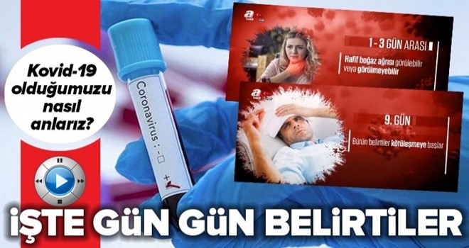 İşte koronavirüsün gün gün gösterdiği belirtiler! .