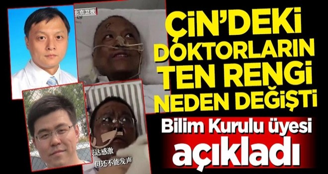 Çin'deki doktorların ten rengi neden değişti! Bilim Kurulu üyesi açıkladı